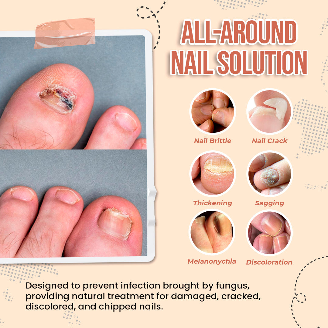 Zakdavi™️ 7 Days Nail Growth and Strengthening Serum