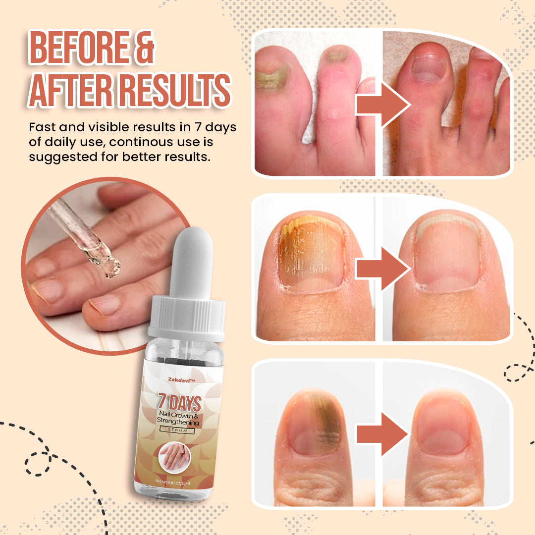 Zakdavi™️ 7 Days Nail Growth and Strengthening Serum
