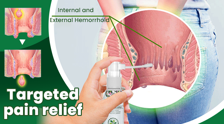 Hemorrhoid Spray