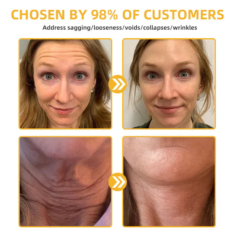 💐🐝ODALIT™ BeeLift Anti-Aging Firming Cream,Address Crepe & Sagging(🔥74% Off for a Limited Time!)