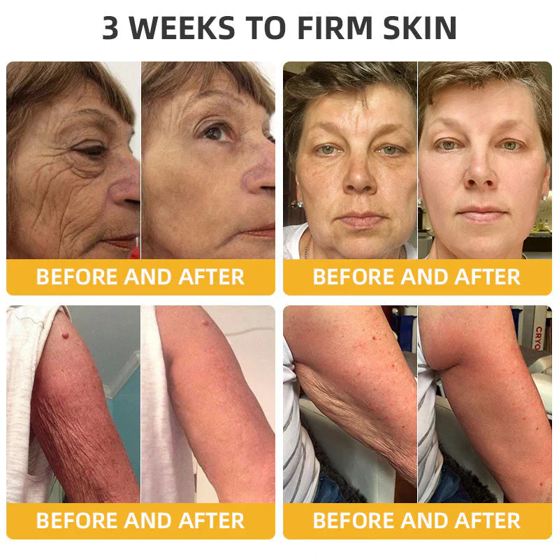 💐🐝ODALIT™ BeeLift Anti-Aging Firming Cream,Address Crepe & Sagging(🔥74% Off for a Limited Time!)