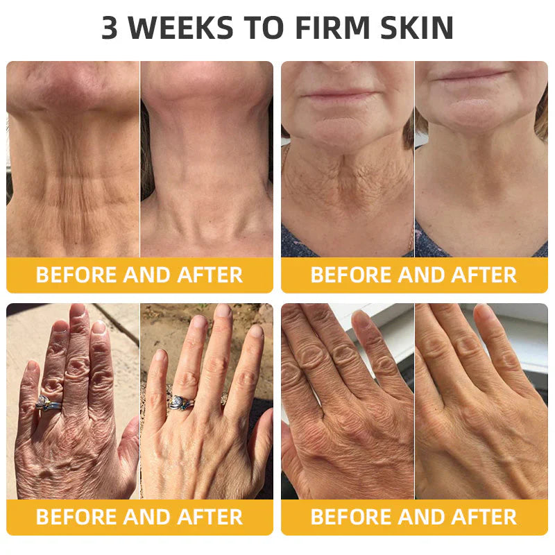💐🐝ODALIT™ BeeLift Anti-Aging Firming Cream,Address Crepe & Sagging(🔥74% Off for a Limited Time!)