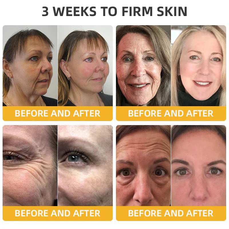 💐🐝ODALIT™ BeeLift Anti-Aging Firming Cream,Address Crepe & Sagging(🔥74% Off for a Limited Time!)