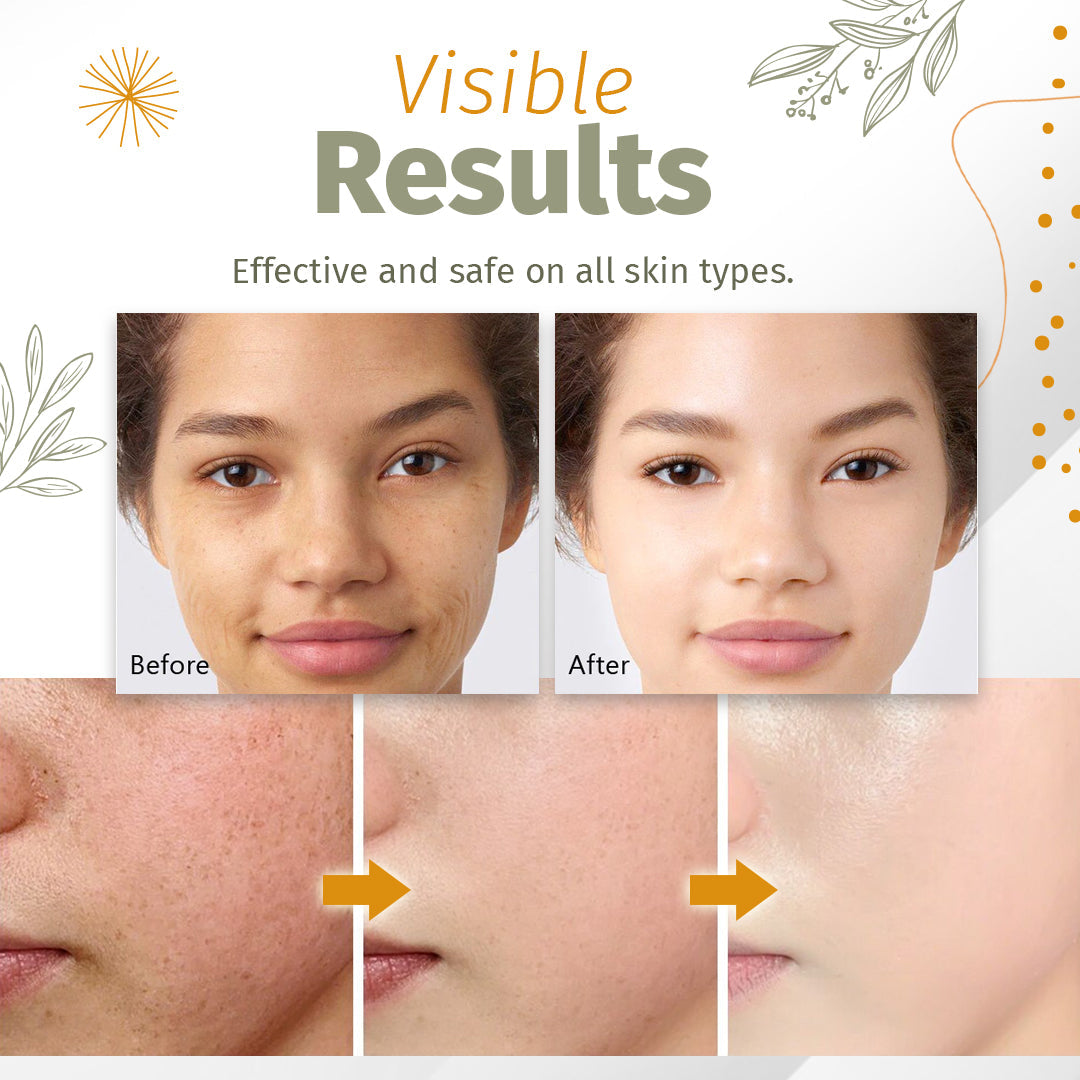 Zakdavi™ Organic Skin Spot Solutions Serum