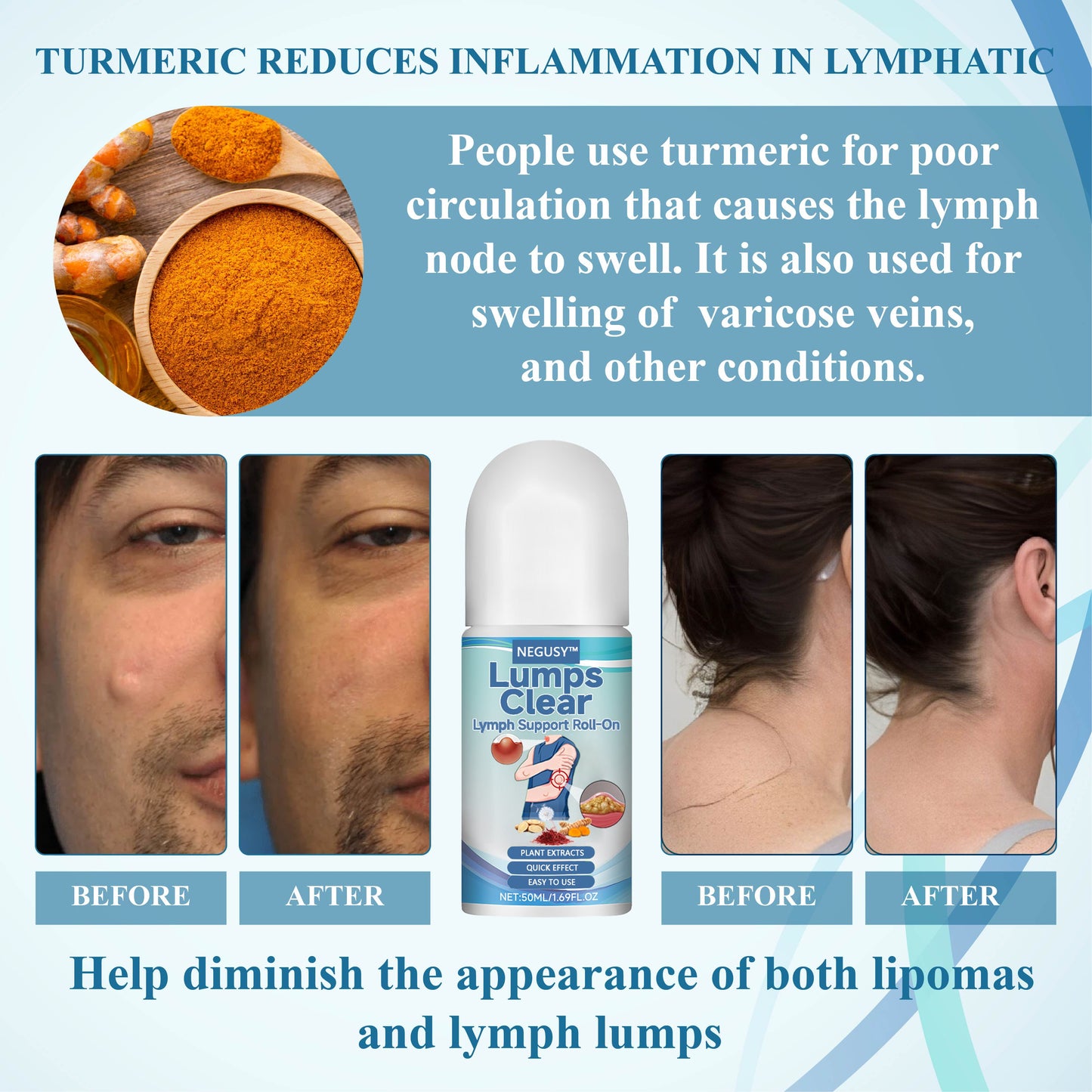NEGUSY™ LumpsClear Lymph Support Roll-On