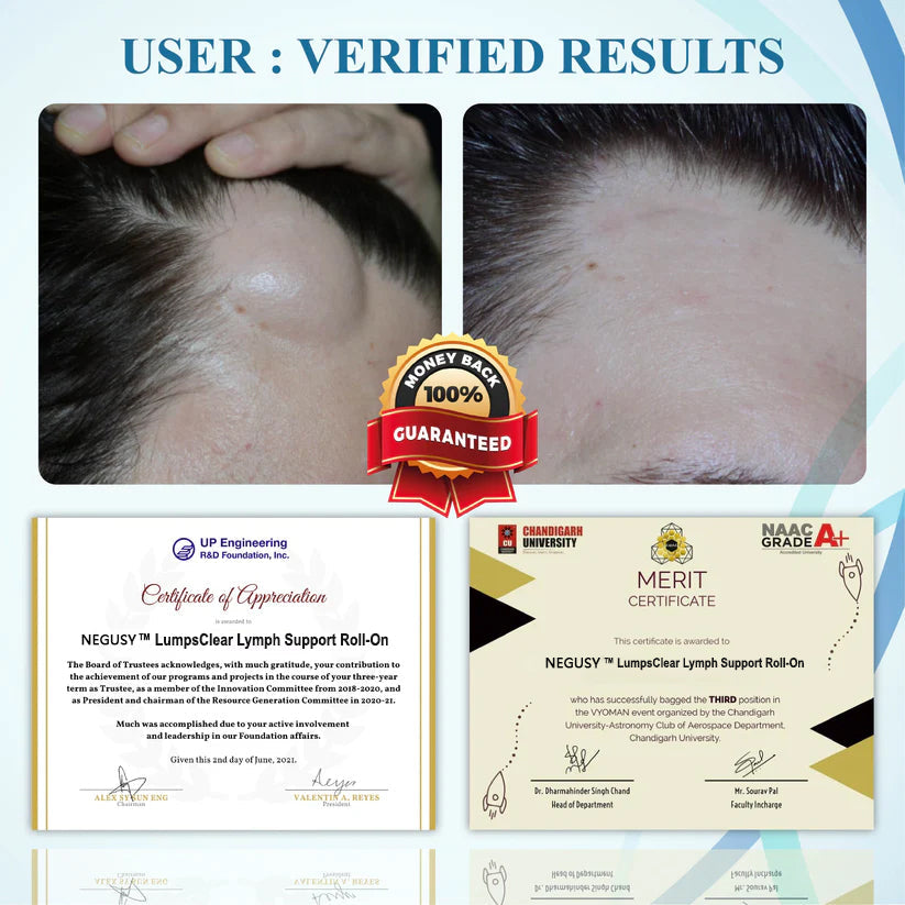 NEGUSY™ LumpsClear Lymph Support Roll-On
