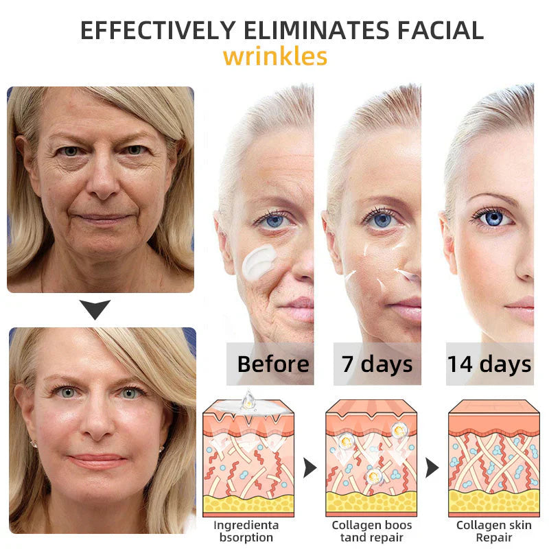 💐🐝ODALIT™ BeeLift Anti-Aging Firming Cream,Address Crepe & Sagging(🔥74% Off for a Limited Time!)