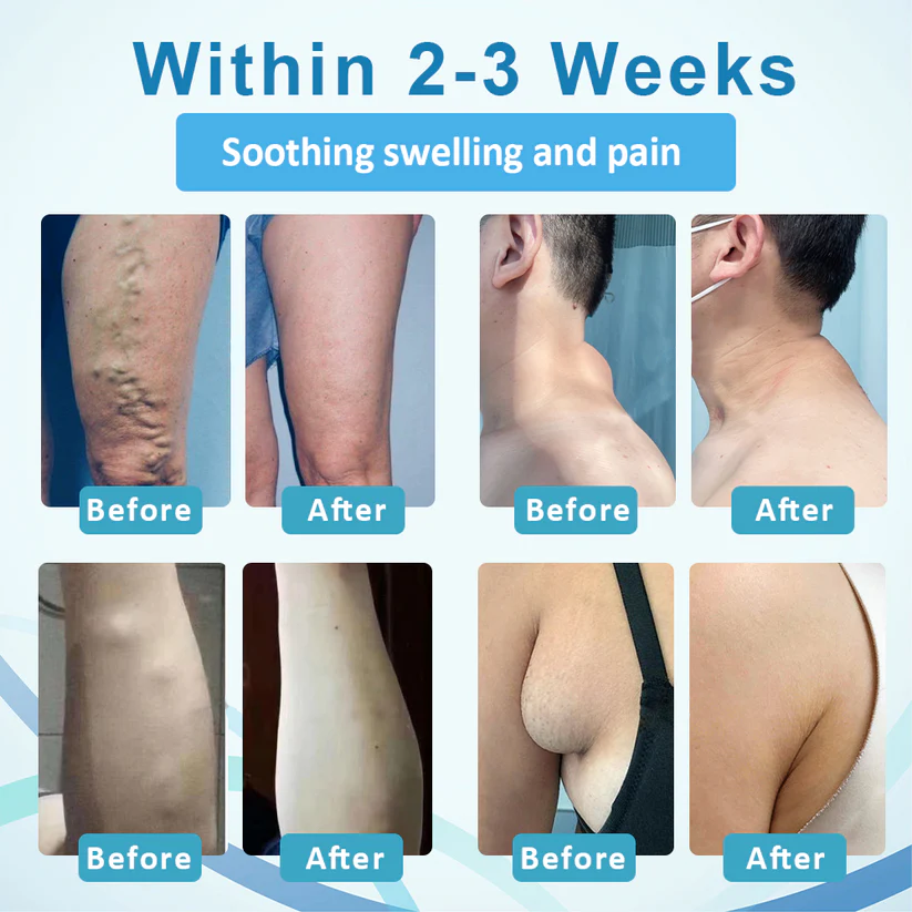 NEGUSY™ LumpsClear Lymph Support Roll-On