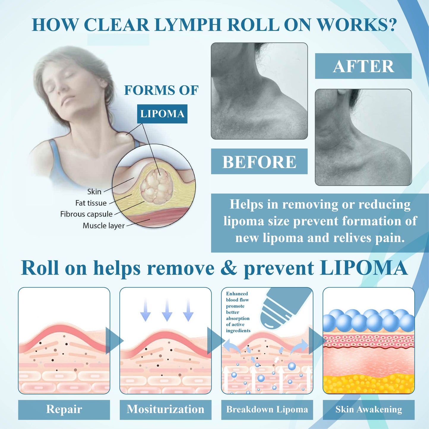 NEGUSY™ LumpsClear Lymph Support Roll-On