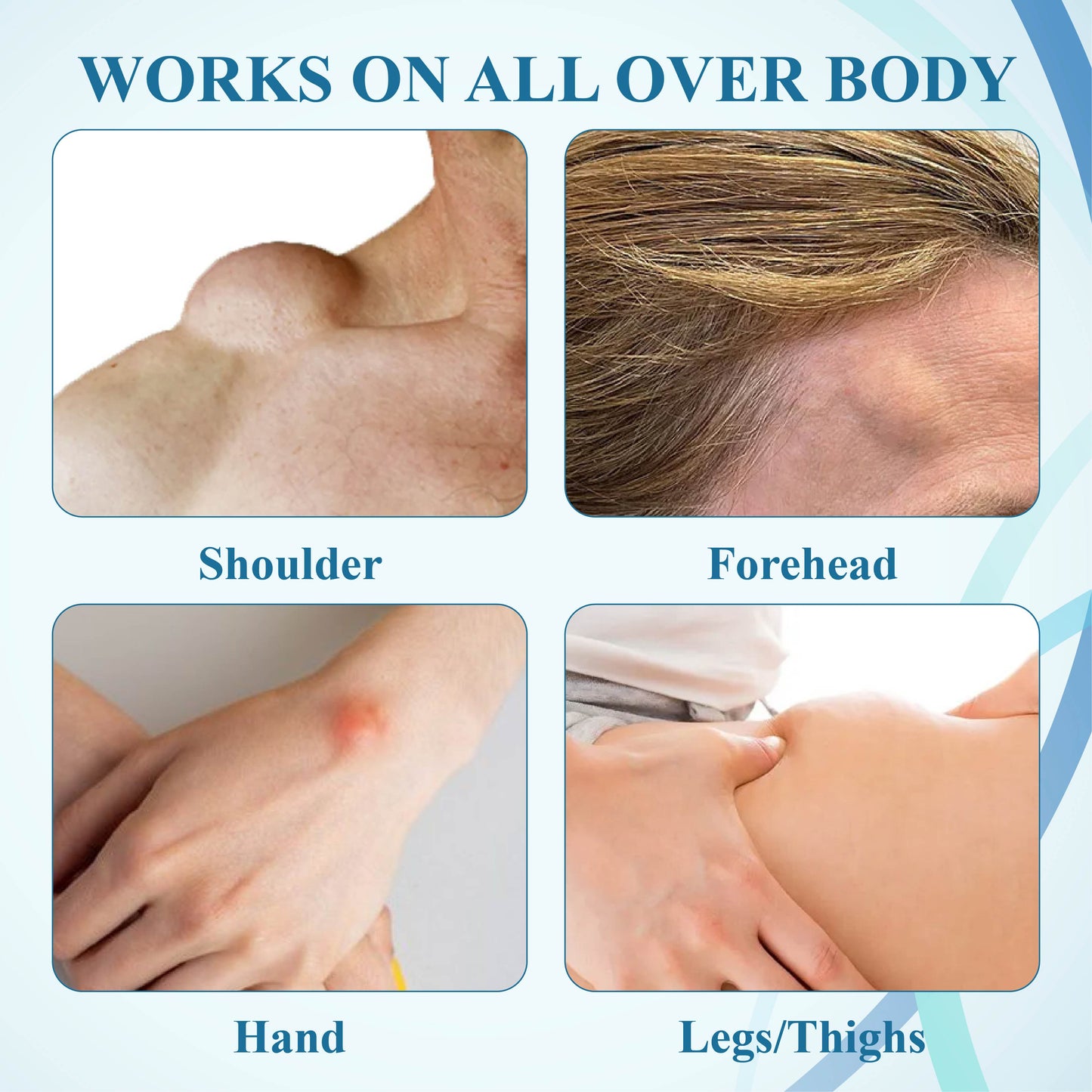 NEGUSY™ LumpsClear Lymph Support Roll-On