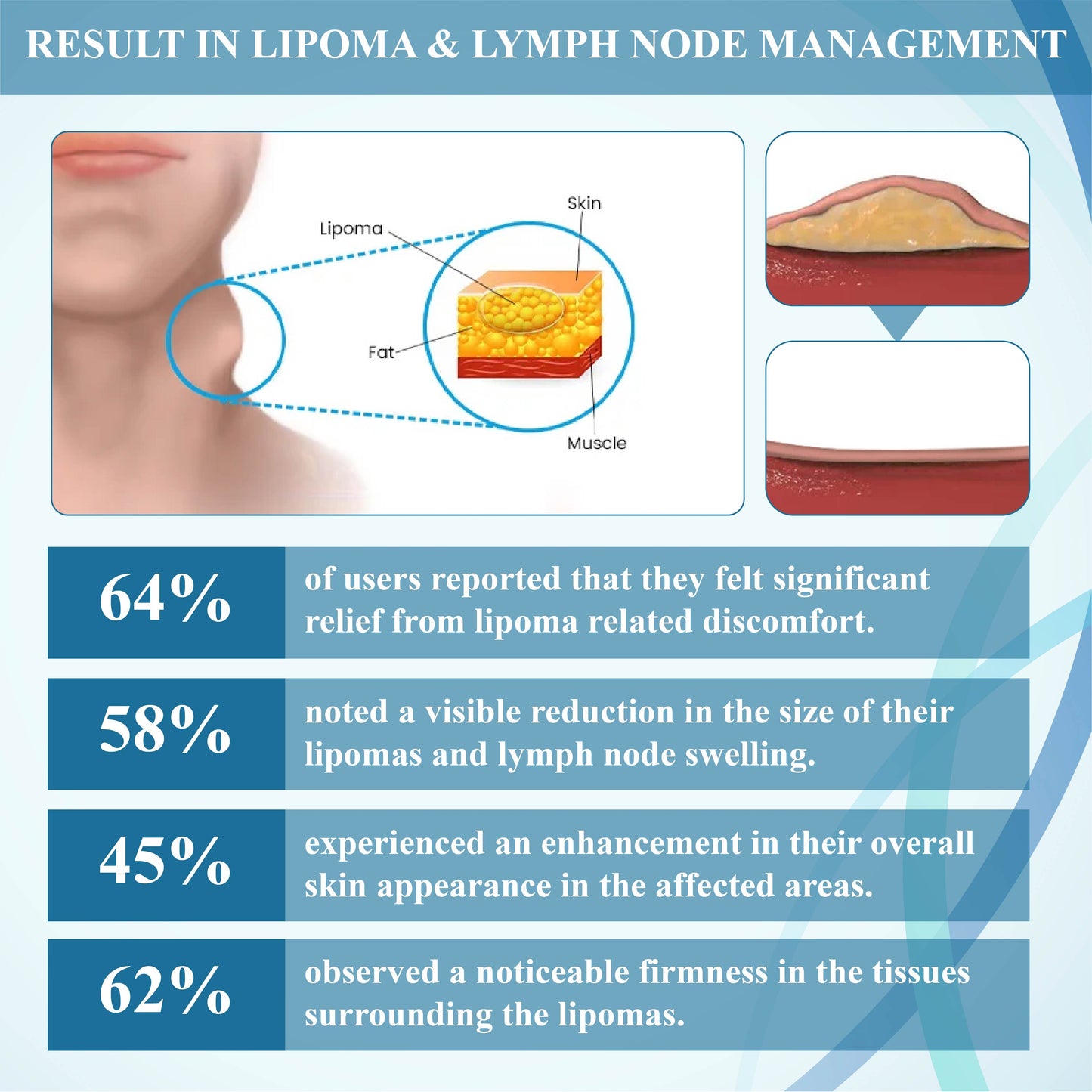 NEGUSY™ LumpsClear Lymph Support Roll-On