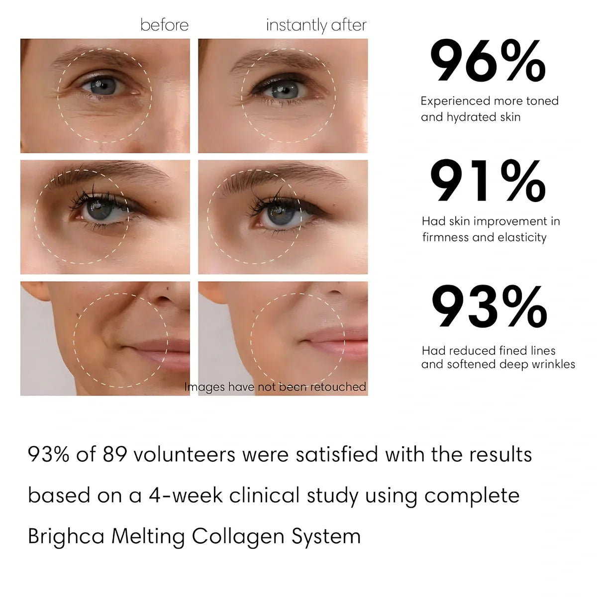 Seurico™ Collagen Melting Patches Kit