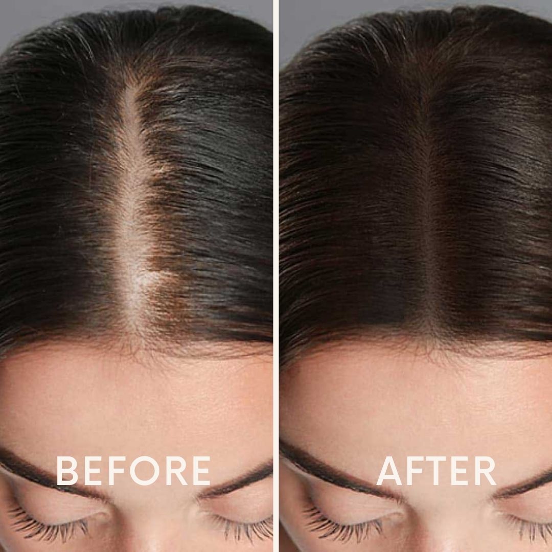 Seurico™ | Laser Cap for Hair Growth ❤️