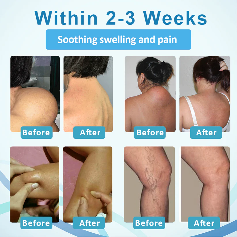 NEGUSY™ LumpsClear Lymph Support Roll-On