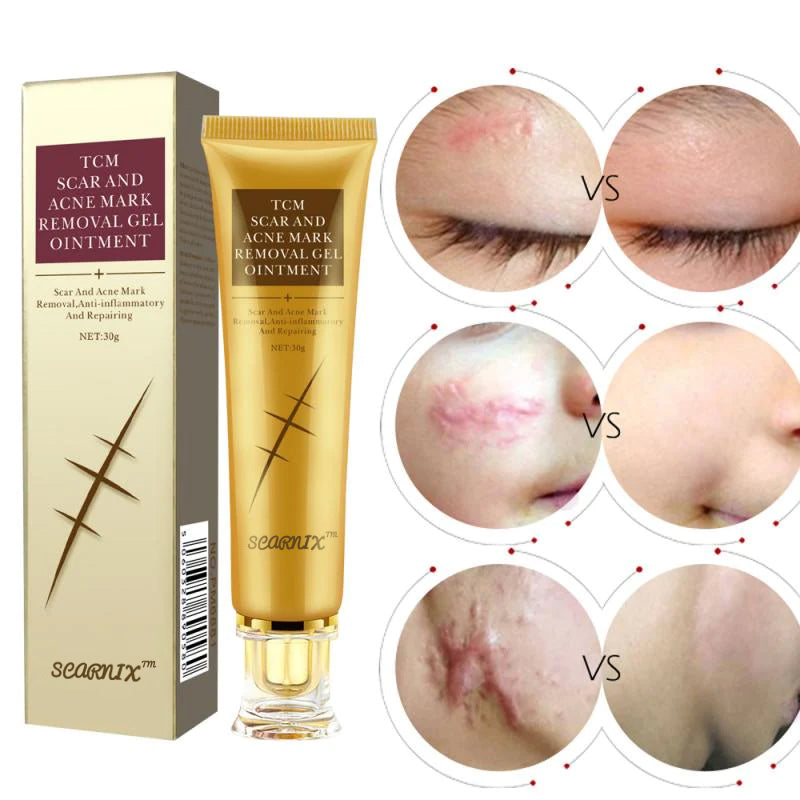 Scarnix™ Scar And Mark Removal Gel Ointment