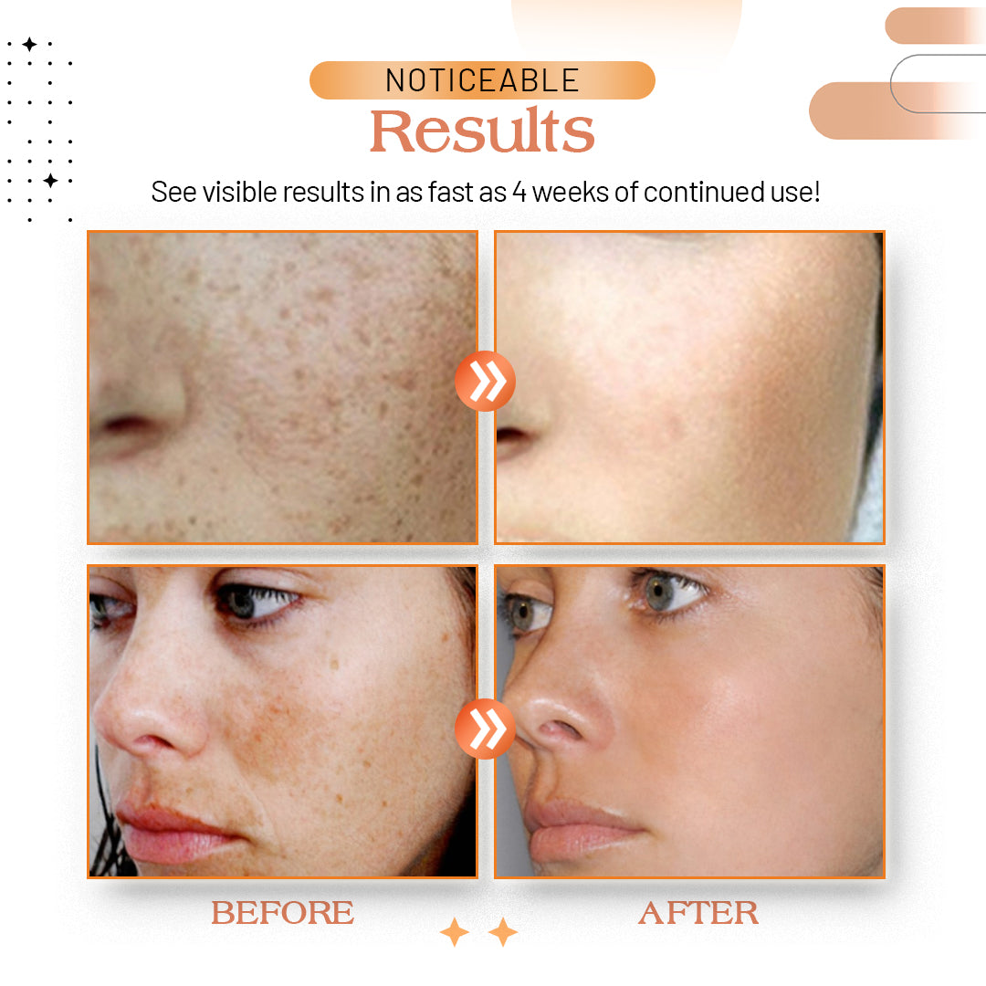 Vivid™ Melanin Removal Skin Balance Serum