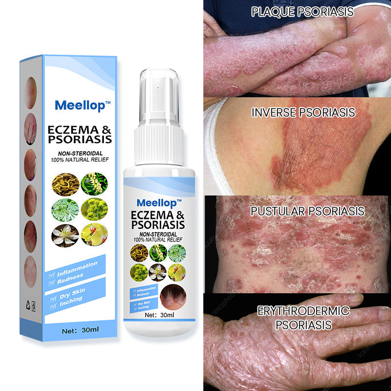 Meellop™ Herbal Psoriasis Relief Spray