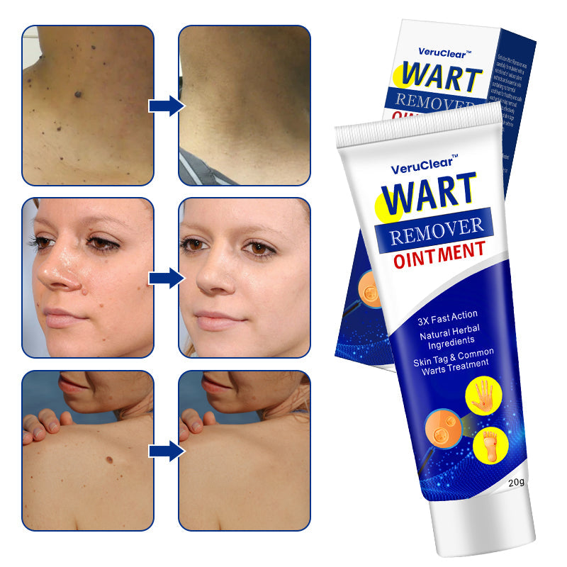 VeruClear™ Wart Remover Ointment