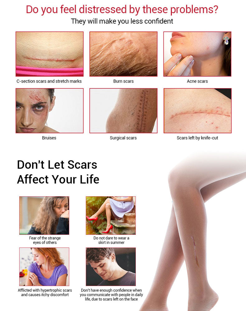 Scarnix™ Scar And Mark Removal Gel Ointment