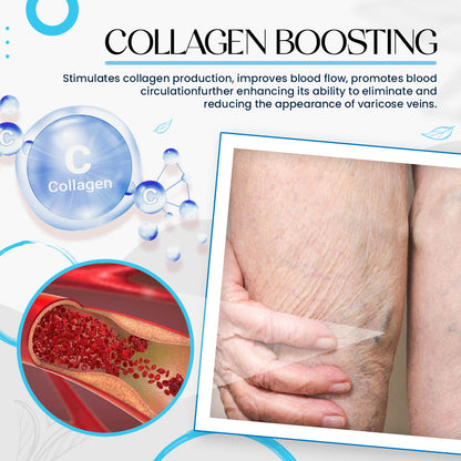 ✨Raura™ Varicose Veins Treatment Cream