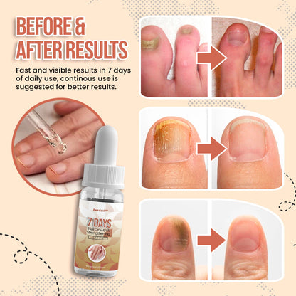 Zakdavi™️ 7 Days Nail Growth and Strengthening Serum
