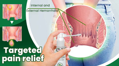 Hemorrhoid Spray