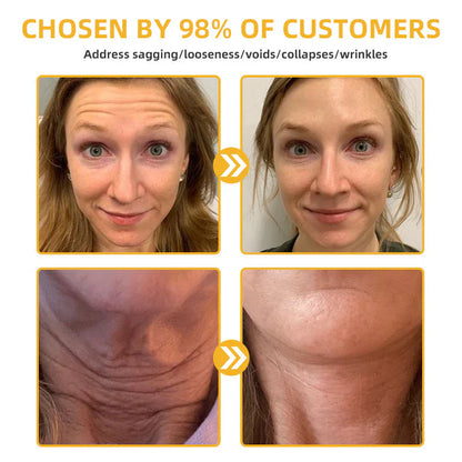 💐🐝ODALIT™ BeeLift Anti-Aging Firming Cream,Address Crepe & Sagging(🔥74% Off for a Limited Time!)