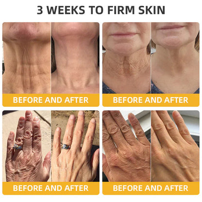 💐🐝ODALIT™ BeeLift Anti-Aging Firming Cream,Address Crepe & Sagging(🔥74% Off for a Limited Time!)