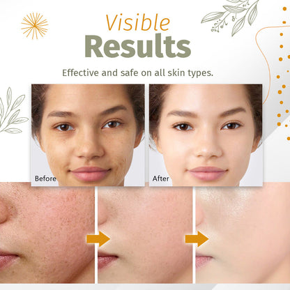 Zakdavi™ Organic Skin Spot Solutions Serum