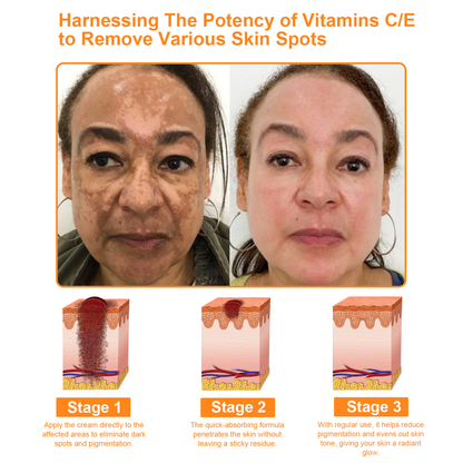 ODALIT™ 7-Day Multi-Effect All-in-One Skincare Cream (👨‍⚕️AAD Recommended)