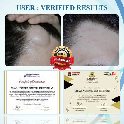 NEGUSY™ LumpsClear Lymph Support Roll-On