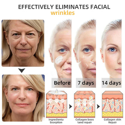 💐🐝ODALIT™ BeeLift Anti-Aging Firming Cream,Address Crepe & Sagging(🔥74% Off for a Limited Time!)
