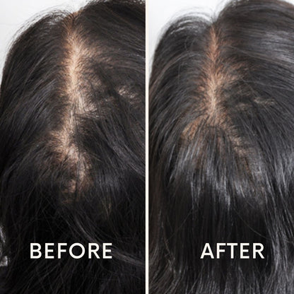 Seurico™ |  Laser Cap for Hair Growth ❤️