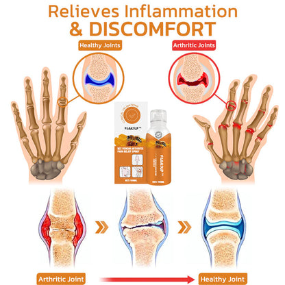 FlexiUp™ Bee Venom Vitamin D Arthritis Joint Pain Relief Spray