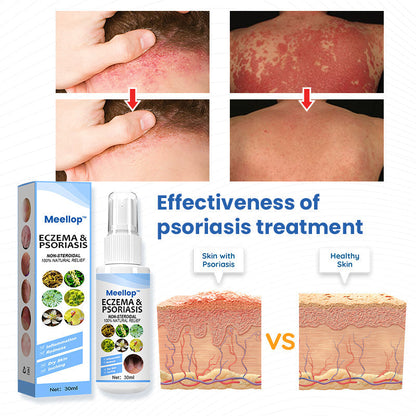 Meellop™ Herbal Psoriasis Relief Spray